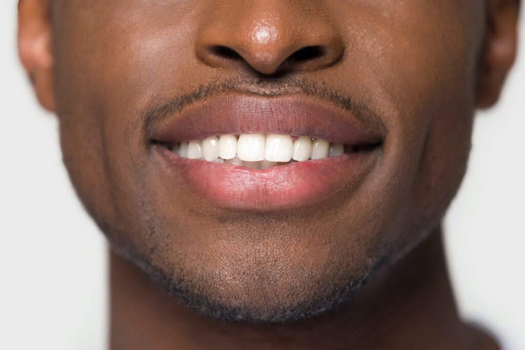 COSMETIC DENTISTRY in BETHESDA MD can help improve your smile, but it's not for everyone
