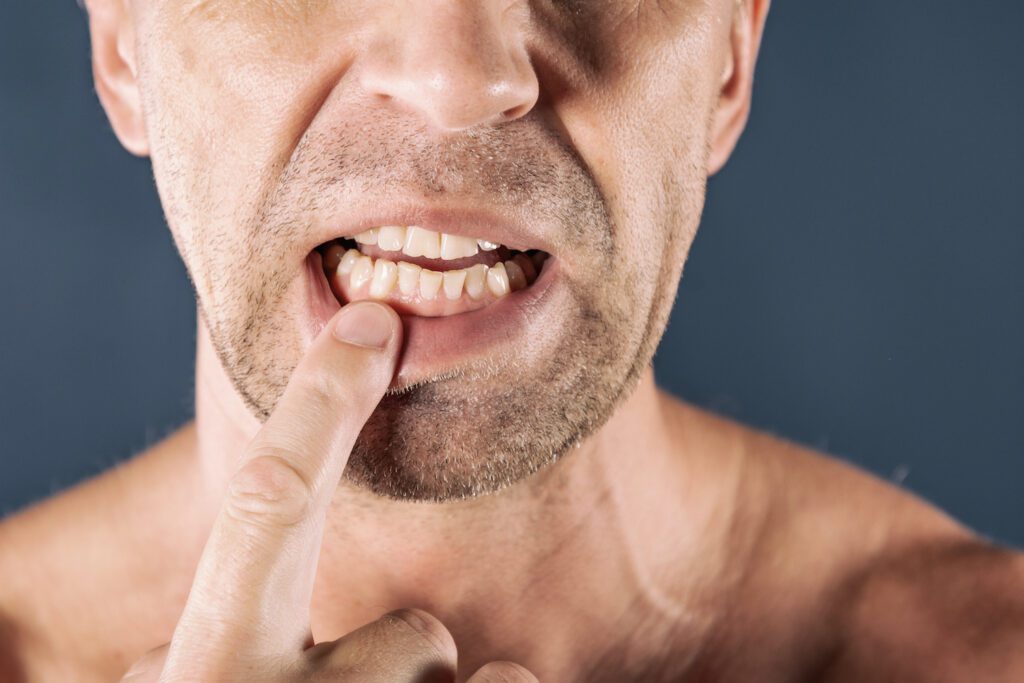 Teeth grinding can lead to severe dental wear and jaw problems over time. Early intervention is key to maintaining your oral health.