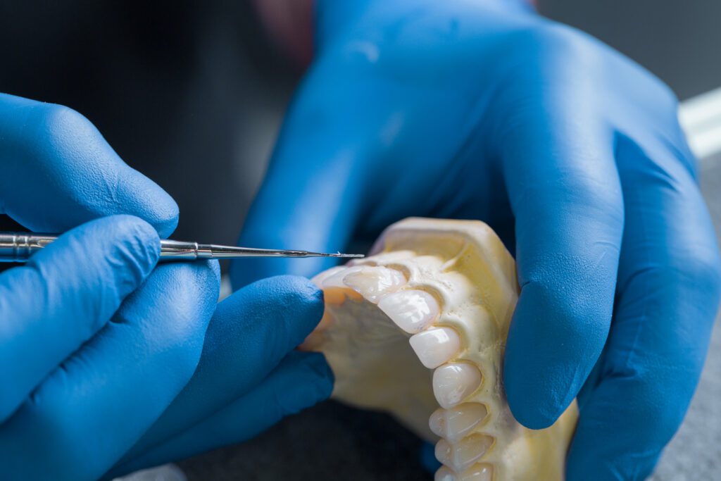 Custom Dentures Bethesda MD